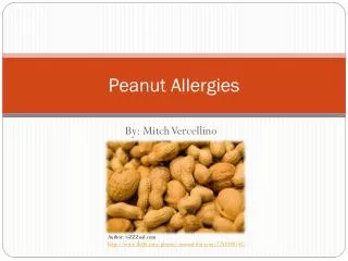 Peanut Allergies