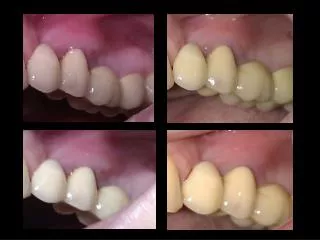 Clinical case