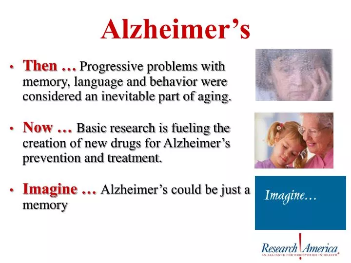 alzheimer s