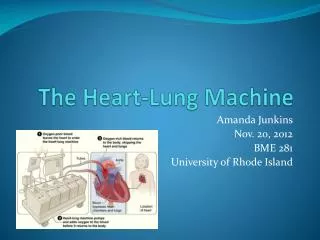 The Heart-Lung Machine