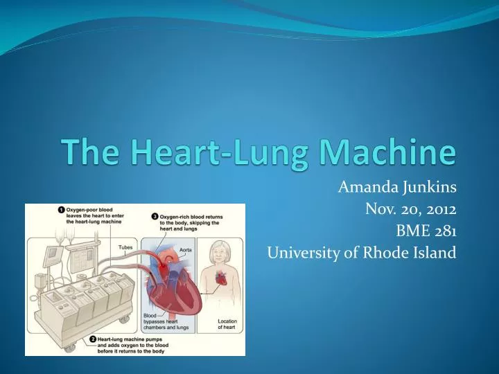 the heart lung machine
