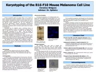 Karyotyping of the B16-F10 Mouse Melanoma Cell Line Christine Widgren Advisor: Dr. Spilatro