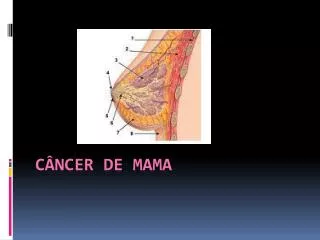 c ncer de mama