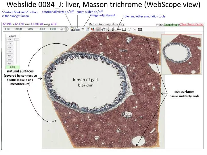 webslide 0084 j liver masson trichrome webscope view