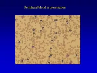 Peripheral blood at presentation