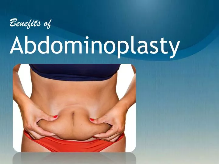 benefits of abdominoplasty