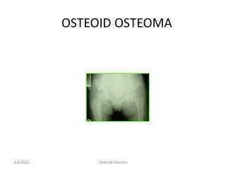 OSTEOID OSTEOMA