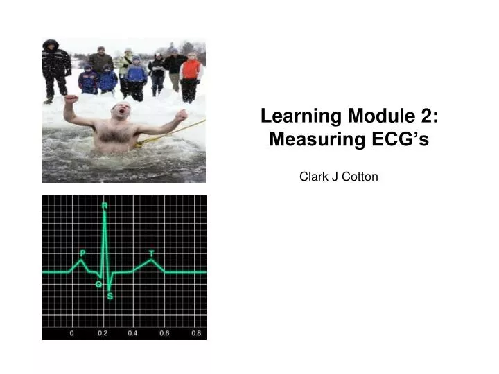 learning module 2 measuring ecg s