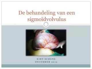 de behandeling van een sigmo dvolvulus