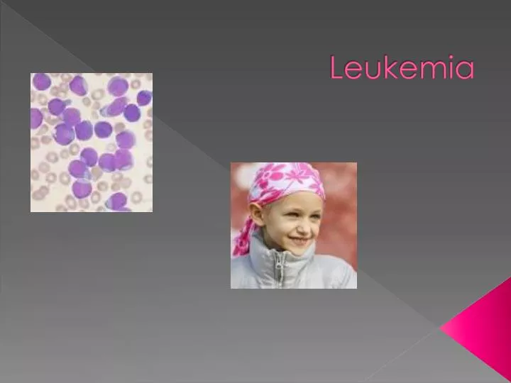 PPT - Leukemia PowerPoint Presentation, Free Download - ID:2711274