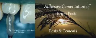 Adhesive Cementation of Endo Posts