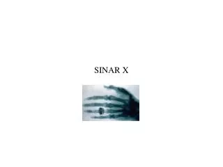 sinar x