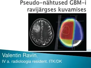 pseudo n htused gbm i ravi j rgses kuvamises