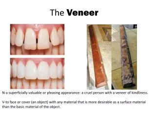 The Veneer
