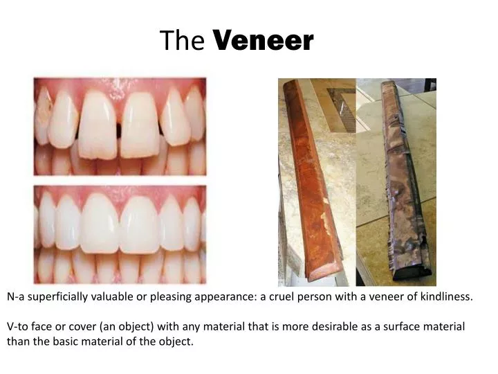 the veneer