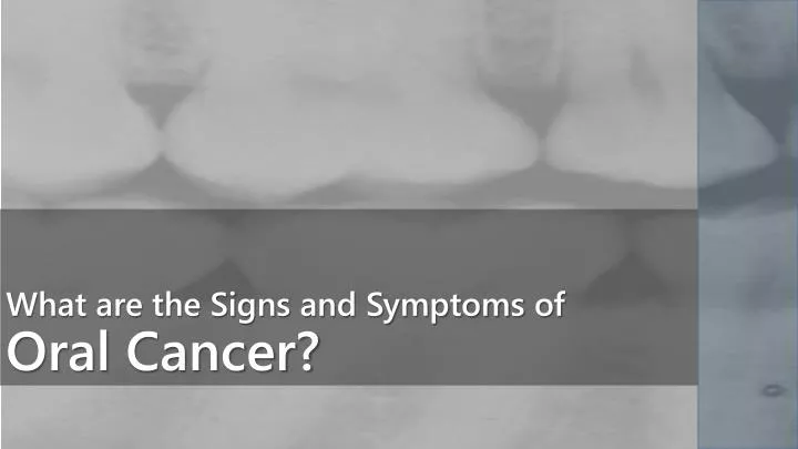 what are the signs and symptoms of oral cancer