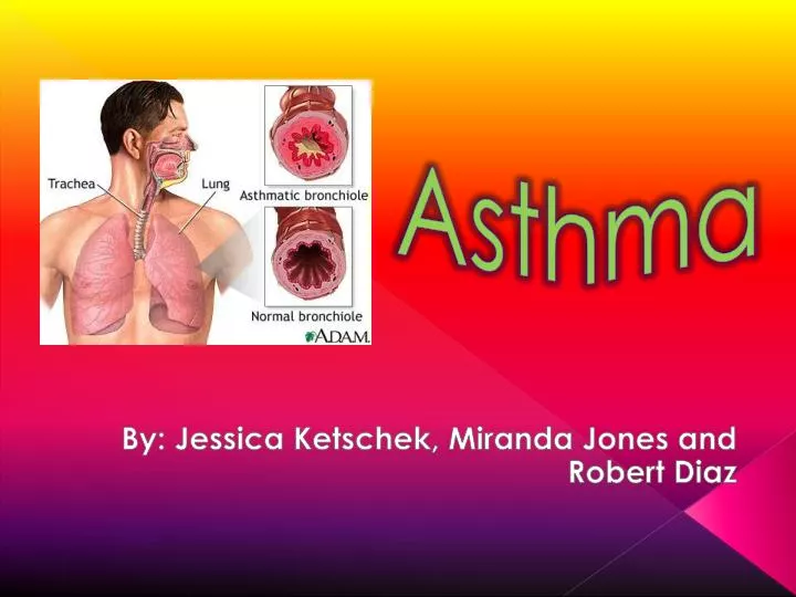 asthma