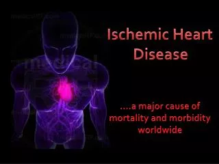 Ischemic Heart Disease