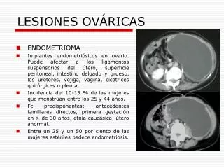 lesiones ov ricas
