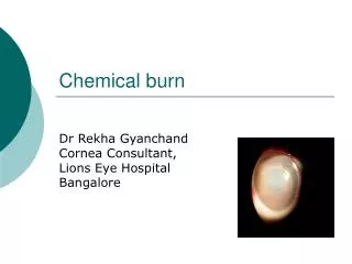 Chemical burn