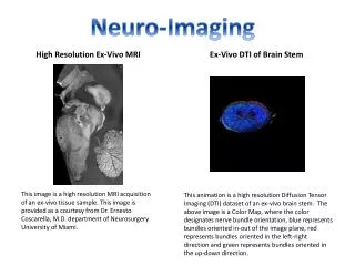 High Resolution Ex-Vivo MRI