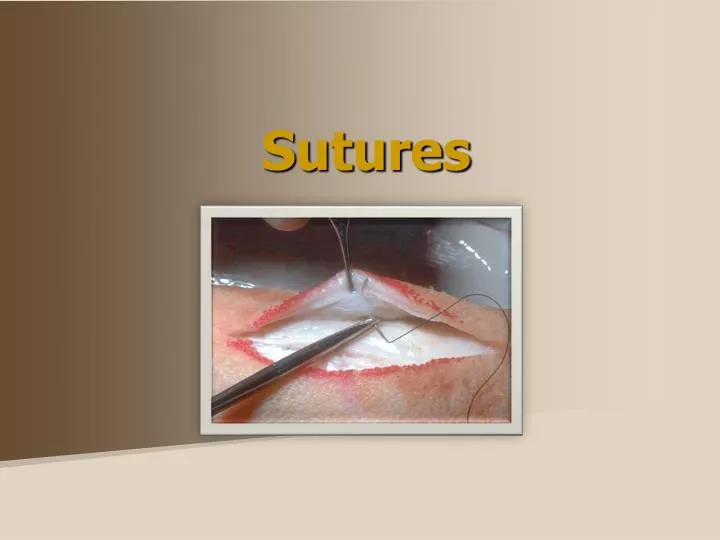 sutures