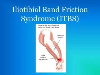 Iliotibial Band Friction Syndrome (ITBS)