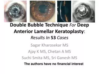 Double Bubble Technique For Deep Anterior Lamellar Keratoplasty : Results In 53 Cases