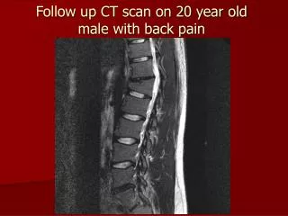 Follow up CT scan on 20 year old male with back pain