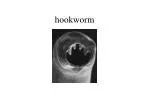 hookworm - slide 1