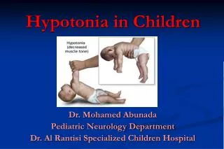 Hypotonia in Children