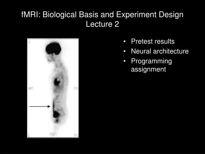 fmri biological basis and experiment design lecture 2