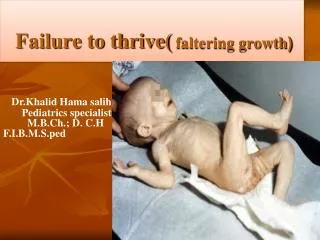 ( Failure to thrive( faltering growth