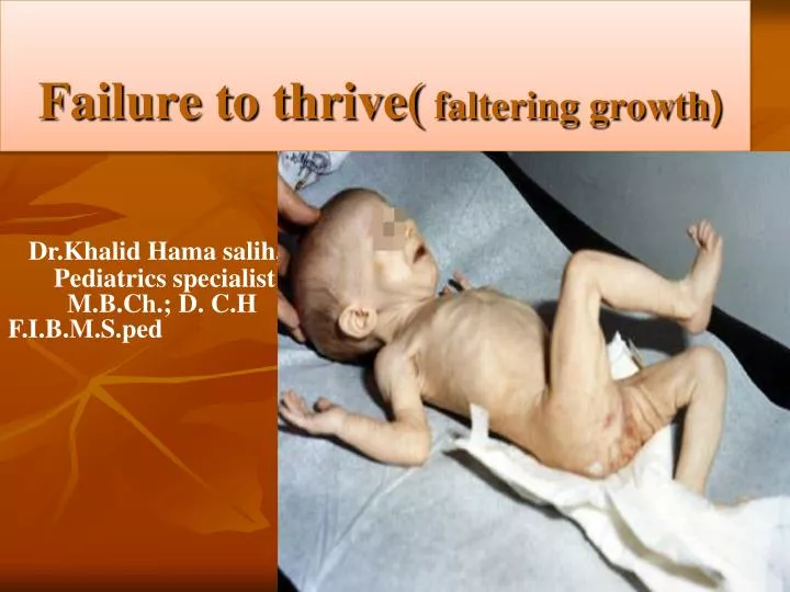 failure to thrive faltering growth