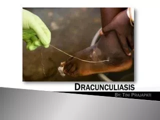 Dracunculiasis