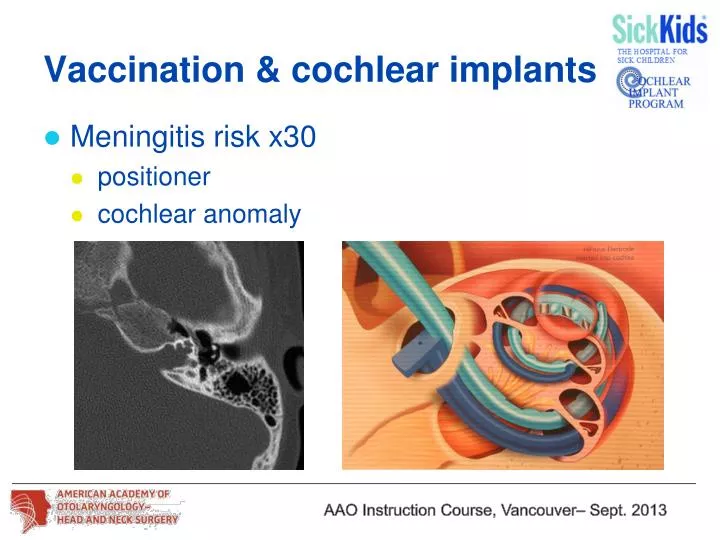 vaccination cochlear implants