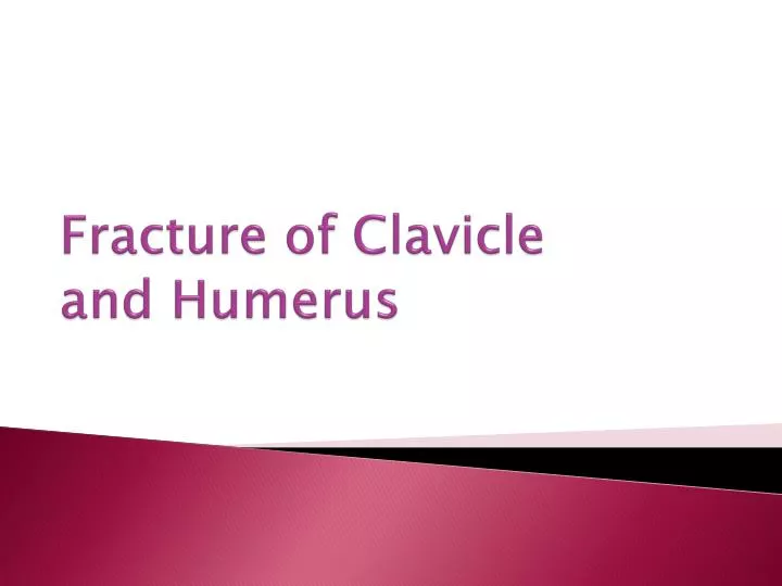 fracture of clavicle and humerus
