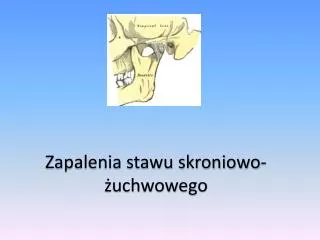 Zapalenia stawu skroniowo-żuchwowego