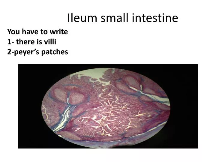 ileum small intestine