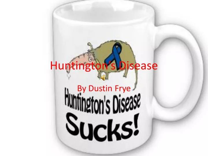 huntington s disease