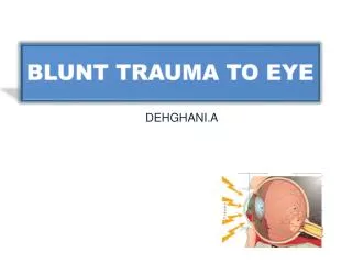 blunt trauma to eye
