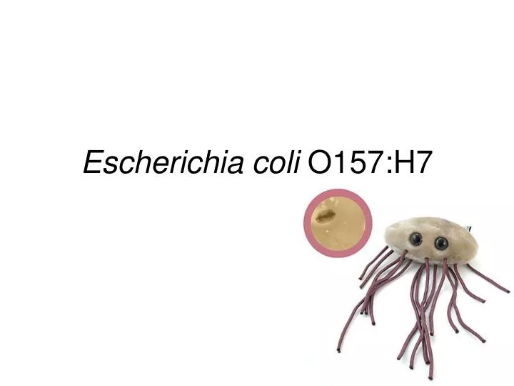 escherichia coli o157 h7