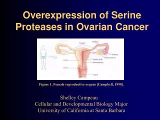 Overexpression of Serine Proteases in Ovarian Cancer