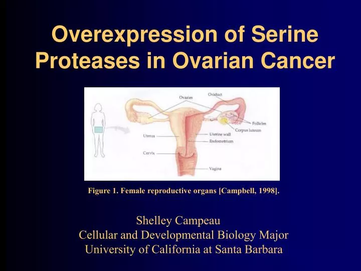 overexpression of serine proteases in ovarian cancer