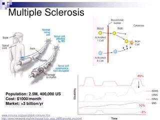 Multiple Sclerosis