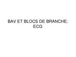 BAV ET BLOCS DE BRANCHE: ECG - slide 1