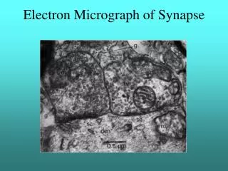 Electron Micrograph of Synapse