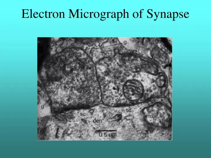 electron micrograph of synapse