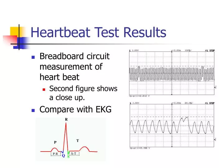 heartbeat test results