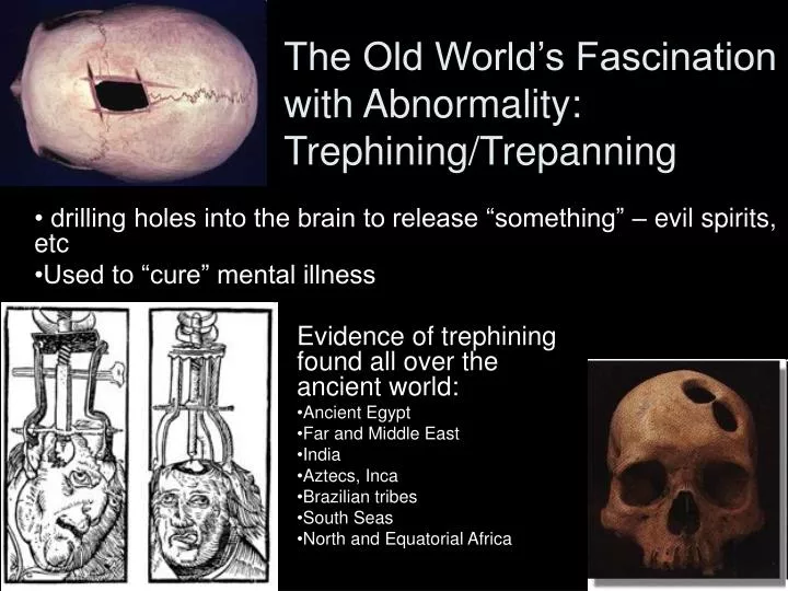 the old world s fascination with abnormality trephining trepanning